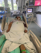 广东32岁快递员患热射病住进ICU，昏迷一